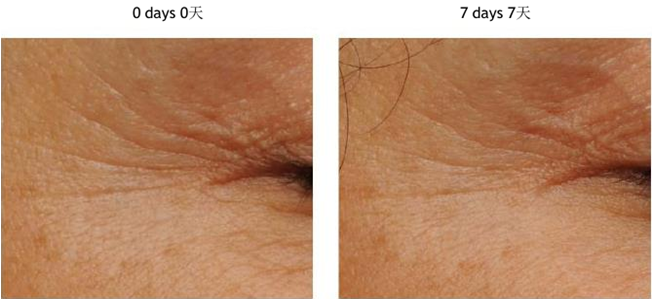 OEM Private Label Firming Eye Cream For Dark Circles And Eye Bag